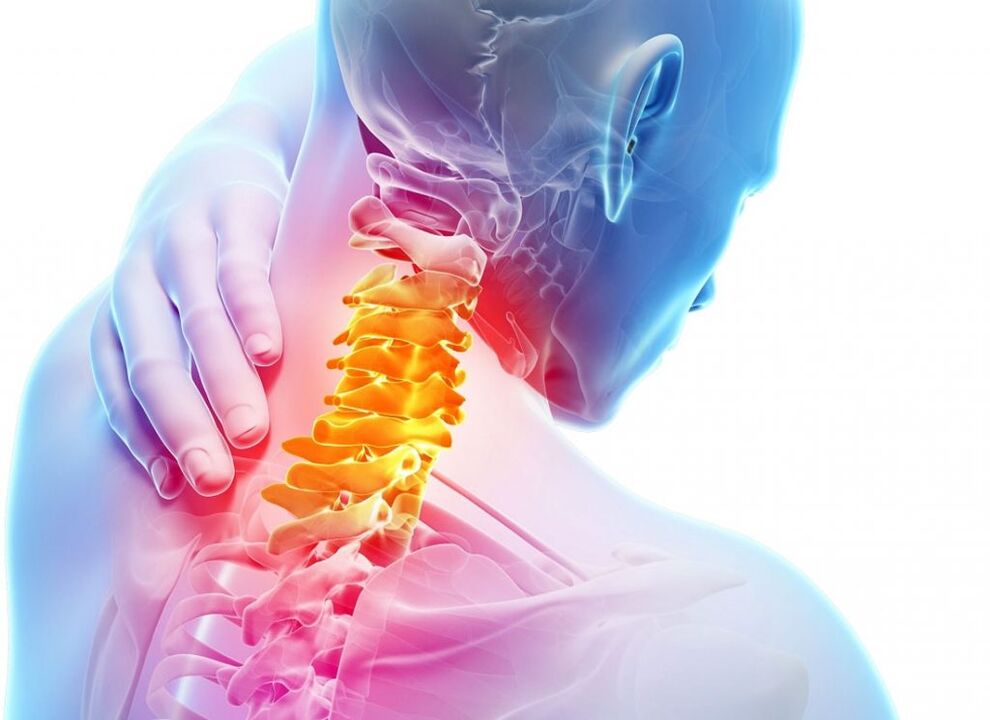 osteohondroza